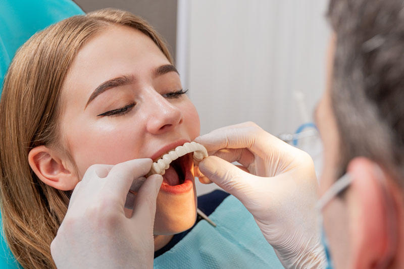 a dental patient getting her final full arch prosthesis placed by a dental professional during her full mouth dental implant procedure process.