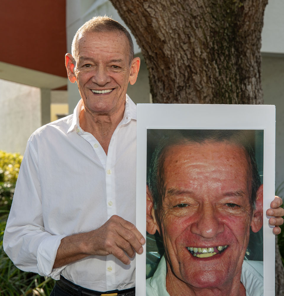 full arch dental implant patient
