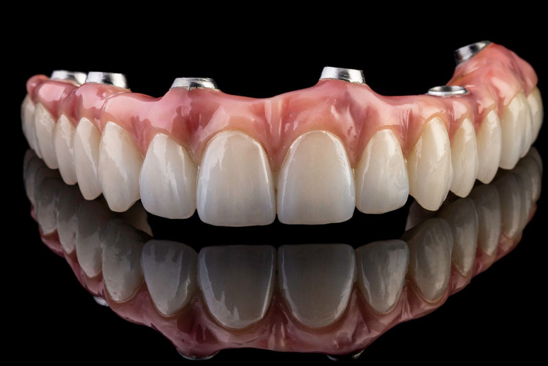 zirconia full arch