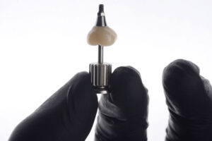 a single dental implant with a screw attached to it