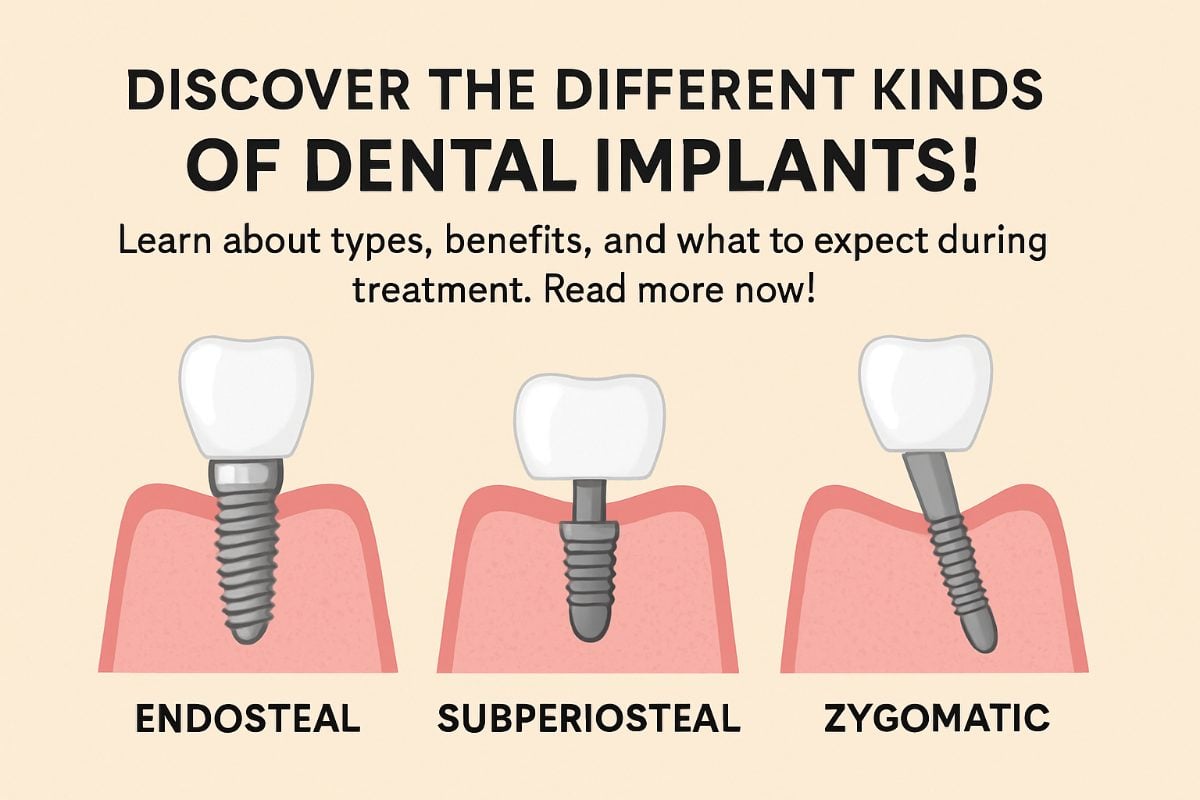 A side-by-side comparison of different kinds of dental implants, including single-tooth implants, implant-supported bridges, All-on-4, subperiosteal implants, and zygomatic implants, each shown with corresponding diagrams of the jawbone and surrounding teeth. No text on image.